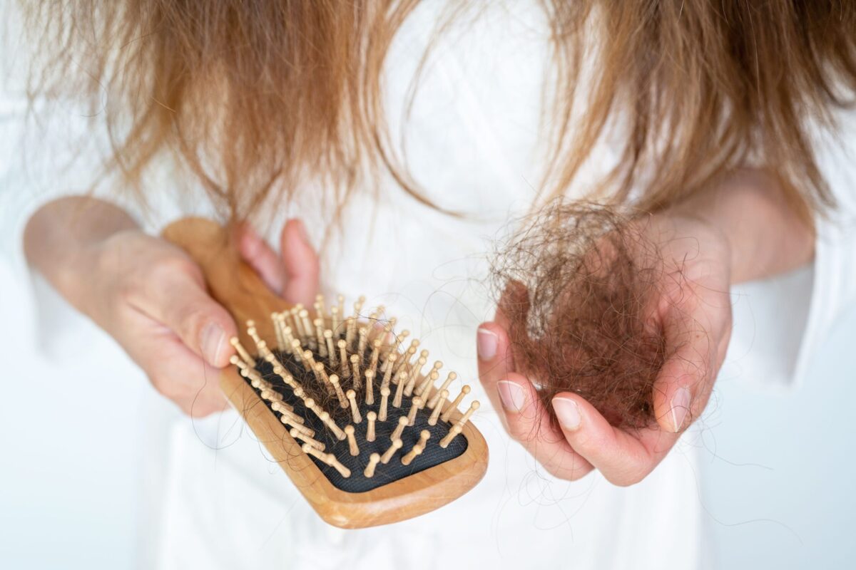 Close-up of thinning hair on a scalp